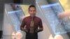 Teknologi "Nora" Hentikan Mendengkur saat Tidur